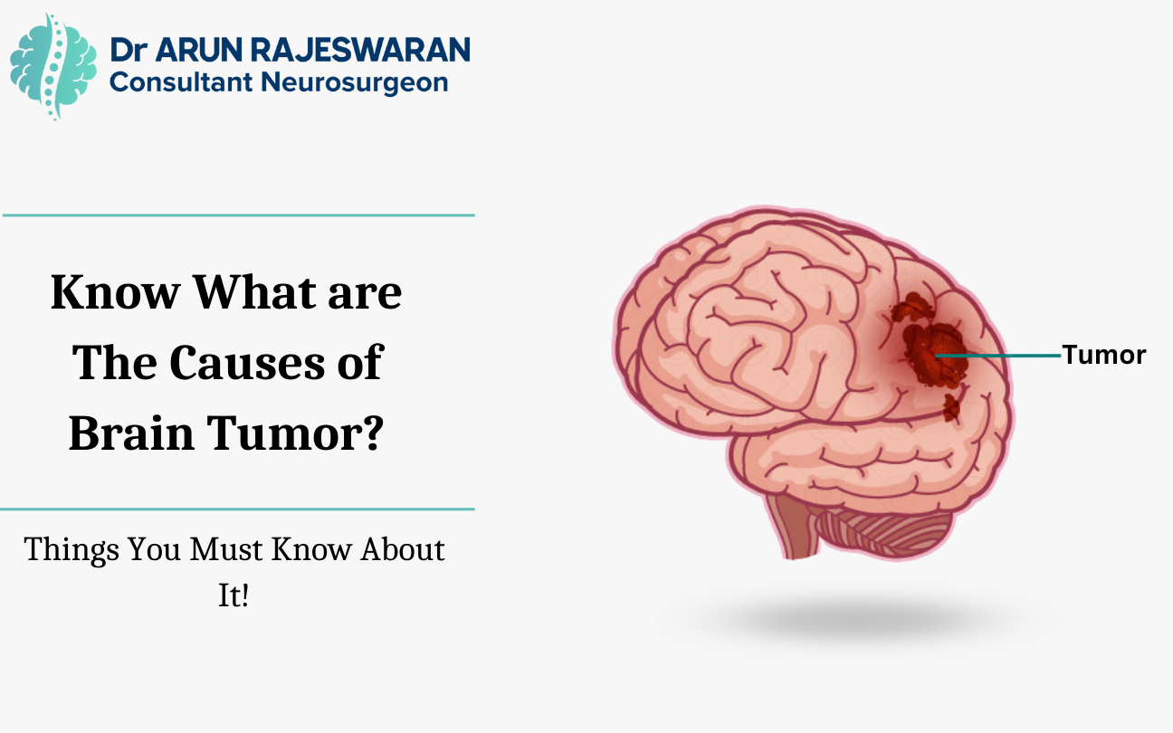 what are the causes of brain tumor
