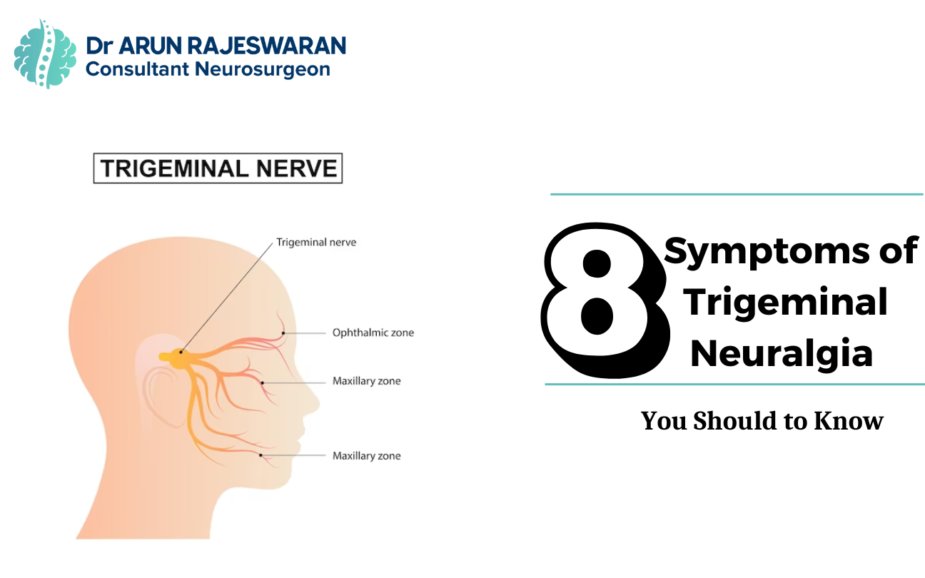 8 Symptoms Of Trigeminal Neuralgia You Should To Know