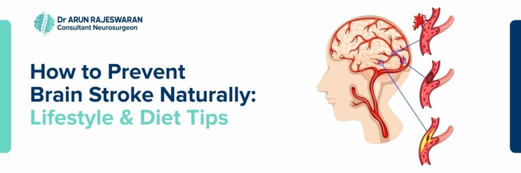 How to Prevent Stroke Naturally: Expert Insights for Better Brain Health in the UAE