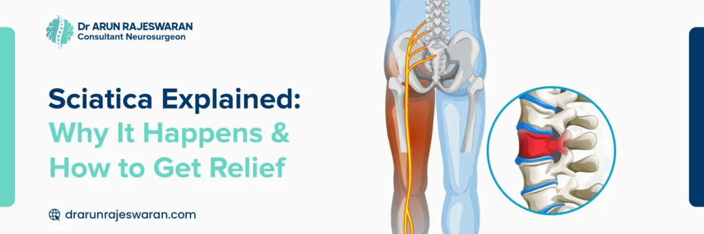 Sciatica Pain Causes, Symptoms & Treatment in Dubai