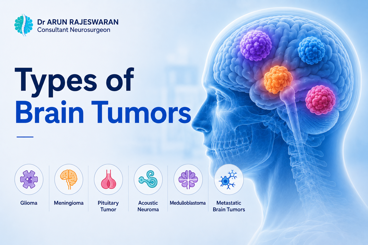Types of Brain Tumors: A Clear Guide from a Neurosurgeon