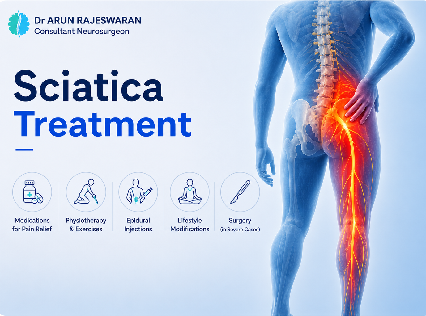 Sciatica Treatment: A Spine Neurosurgeon’s Guide to Relief, Recovery, and When Surgery Is Needed
