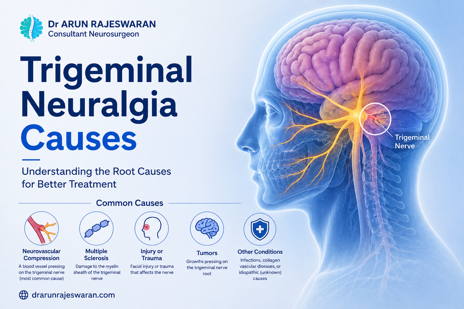 What Causes Trigeminal Neuralgia? A Neurosurgeon Explains